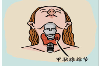 未标题-1.jpg
