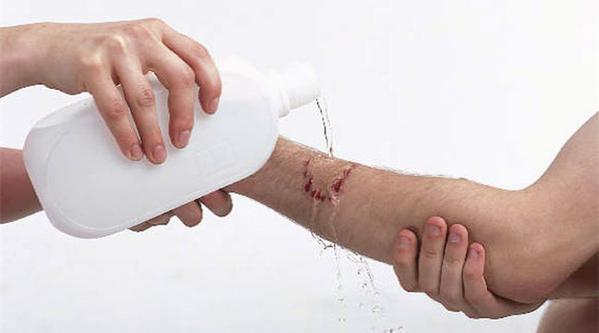 又快到狂犬高发季,是时候祭出这篇文章了